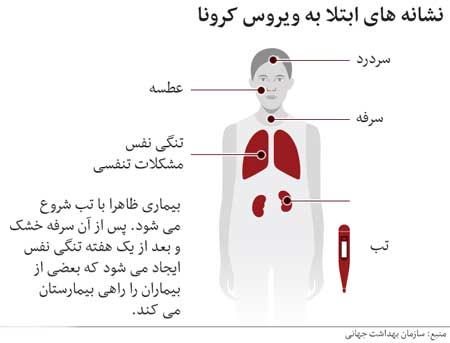 آشنایی با علائم ویروس کرونا